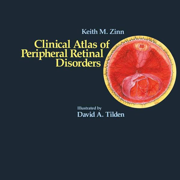 Keith M. Zinn Zinn Clinical Atlas of Peripheral Retinal Disorders