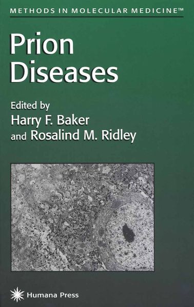  Baker Prion Diseases