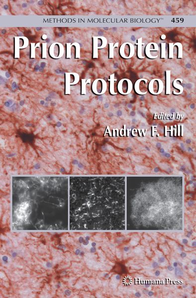 Hill Prion Protein Protocols