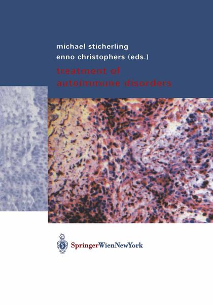  Sticherling Treatment of Autoimmune Disorders