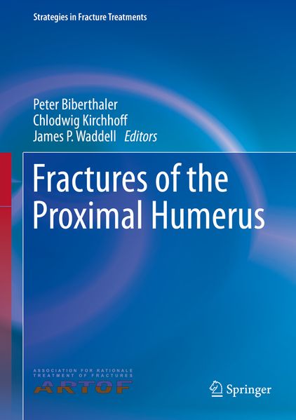  Biberthaler Fractures of the Proximal Humerus