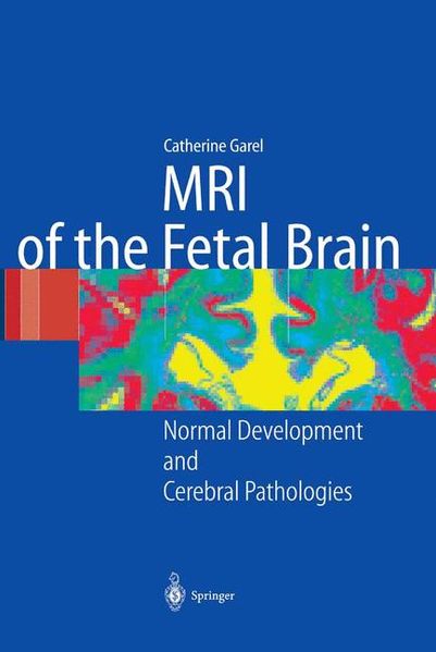 C. Garel Garel MRI of the Fetal Brain