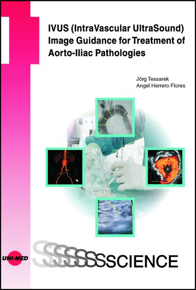 Jörg Tessarek Angel Herrero Flores Tessarek IVUS (IntraVascular UltraSound) Image Guidance for Treatment of Aorto-Iliac Pathologies