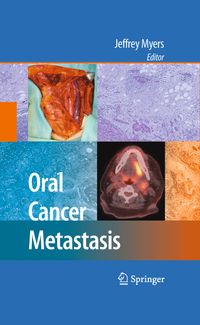 Buch Cover Oral Cancer Metastasis