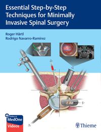 Buch Cover Essential Step-by-Step Techniques for Minimally Invasive Spinal Surgery