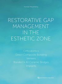 Buch Cover Restorative Gap Management in the Esthetic Zone