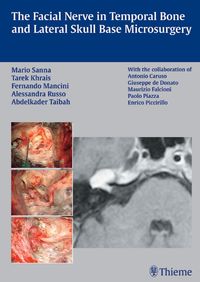 Buch Cover The Facial Nerve in Temporal Bone and Lateral Skull Base Microsurgery