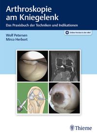 Buch Cover Arthroskopie am Kniegelenk