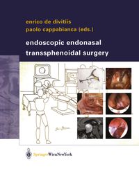Buch Cover Endoscopic Endonasal Transsphenoidal Surgery