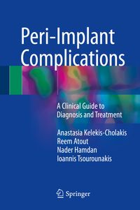 Buch Cover Peri-Implant Complications