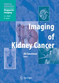 Buch Cover Imaging of Kidney Cancer