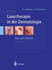 Buch Cover Lasertherapie in der Dermatologie