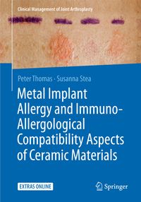 Buch Cover Metal Implant Allergy and Immuno-Allergological Compatibility Aspects of Ceramic Materials