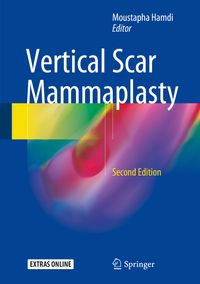 Buch Cover Vertical Scar Mammaplasty