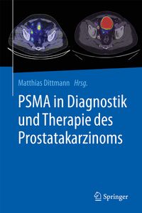 Buch Cover PSMA in Diagnostik und Therapie des Prostatakarzinoms