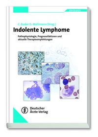 Buch Cover Indolente Lymphome