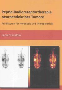 Buch Cover Peptid-Radiorezeptortherapie neuroendokriner Tumore
