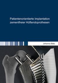 Buch Cover Patientenorientierte Implantation zementfreier Hüftendoprothesen