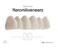 Buch Cover Keramikveneers