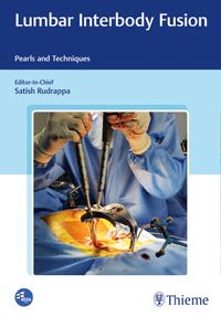 Buch Cover Lumbar Interbody Fusion